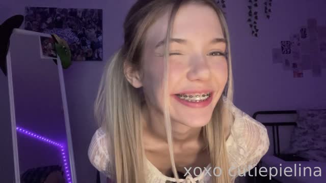 Braces Babe